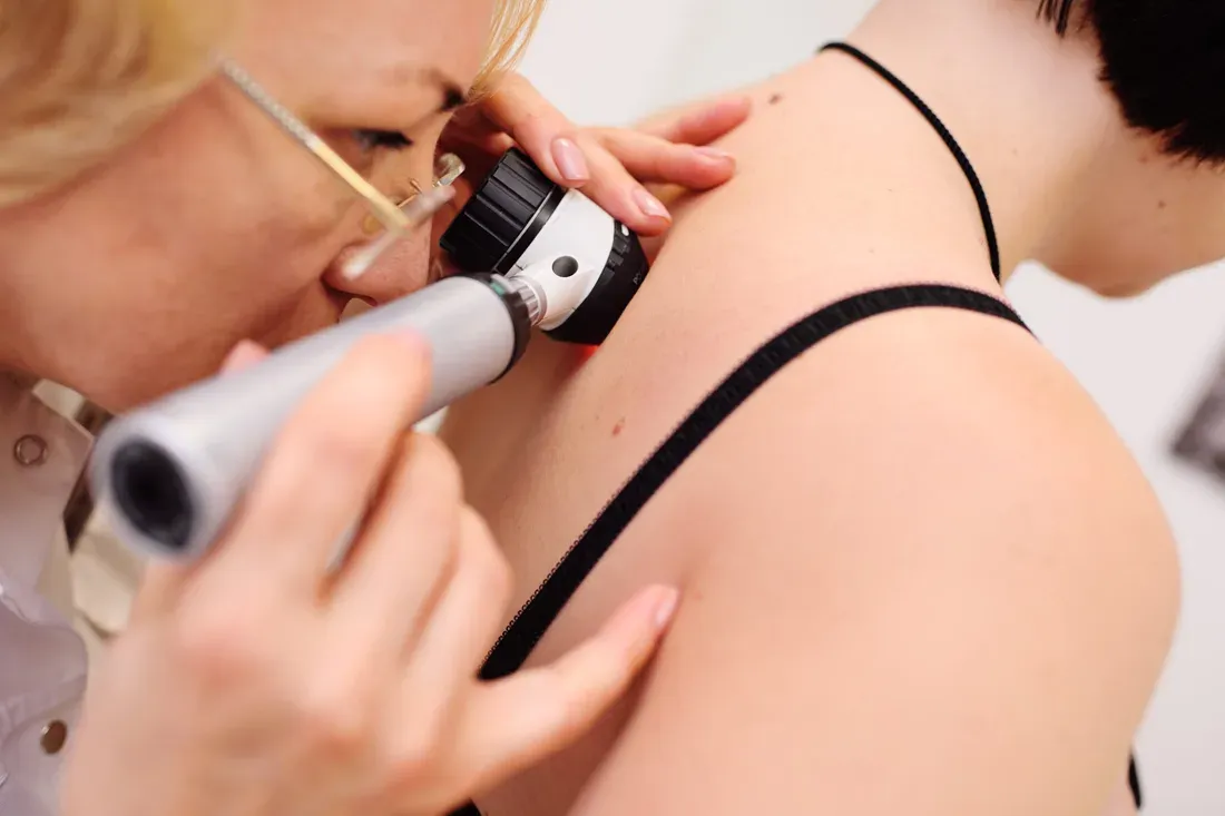 Dermatologist examining a woman's shoulder with a dermatoscope