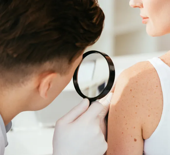 A patient with significant facial redness and rosacea symptoms on her cheek looks up during a skin consultation.