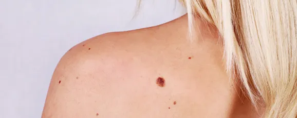 Neurotoxin Services - Palm Beach Dermatology Group