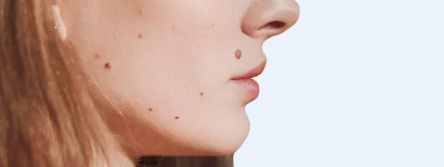 Mohs Surgery - Palm Beach Dermatology Group