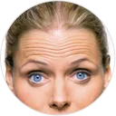 Neurotoxin Services - Palm Beach Dermatology Group - Forehead lines