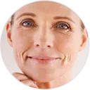Fine lines and wrinkles