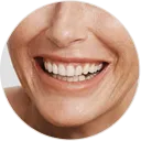 Neurotoxin Services - Palm Beach Dermatology Group - Smile lines
