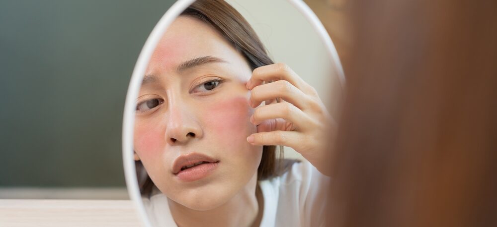 Discovering the Best Skincare for Rosacea: Effective Strategies for Management - Palm Beach Dermatology Group - PGA Dermatology Skin & Aesthetics Center