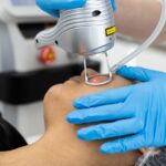 Unlocking Radiant Skin: Laser Treatment for Rosacea at Palm Beach Dermatology Group - Dermatology Clinic - PGA Dermatology Skin & Aesthetics Center