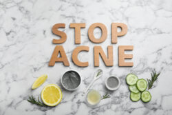 Natural Remedies for Forehead Acne - Stop Ance - How to Get Rid of Forehead Acne: Simple Tips for Clear Skin - How to Prevent Forehead Acne - Simple Skincare Habits for Clear Skin - Palm Beach Dermatology Group - PGA Dermatology Skin & Aesthetics Center