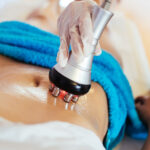 Liposuction Recovery: Comprehensive Guide to Healing & Care - What Happens During Liposuction? - Types of Liposuction Procedures