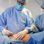 How Painful Is Liposuction? What to Expect - What is Liposuction?: Traditional Liposuction - Laser-Assisted Liposuction (SmartLipo) - Ultrasound-Assisted Liposuction (VASER) - Factors That Affect Pain During Liposuction - Pain After Liposuction - Recovery and Pain After Liposuction - Tips for Minimizing Pain and Discomfort - When to Seek Medical Help - What to Expect During Liposuction Recovery