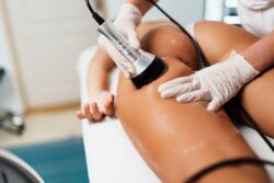 Liposuction Recovery: Comprehensive Guide to Healing & Care - What Happens During Liposuction? - Types of Liposuction Procedures