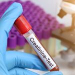 Does Creatine Cause Hair Loss? - Creatine and Hair Loss: Myths vs. Facts - Palm Beach Dermatology Group