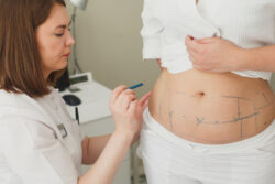 Is Liposuction Safe? What You Need to Know - What is Liposuction? - Types of Liposuction - Benefits of Liposuction 