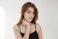 Can White People Have Vitiligo? / What Is Vitiligo? / Can White People Have Vitiligo? / Why Is Vitiligo Less Noticeable in White People? / Causes of Vitiligo / How Is Vitiligo Diagnosed in White People? / Treatment Options / Emotional and Psychological Impact of Vitiligo / Famous White People with Vitiligo / Common Myths Debunked / Can Vitiligo Be Prevented? / PGA Dermatology / Palm Beach Dermatology Group / Palm Beach Dermatologist
