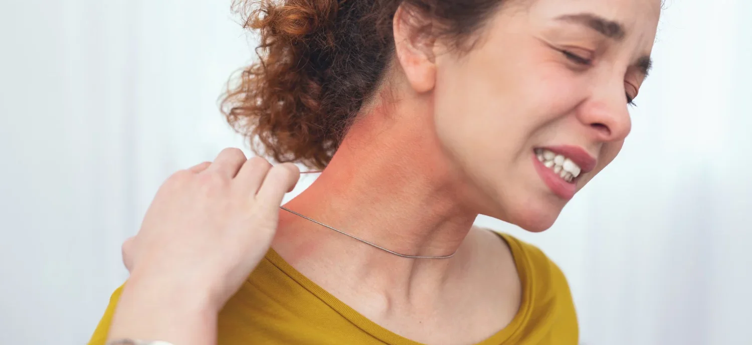 Are Hives Contagious? A Simple Guide / What Are Hives? / What Do Hives Look and Feel Like? / Are Hives Contagious? / When the Underlying Cause Might Be Contagious / Other Common Causes of Hives / Can Children Get Hives? / How Are Hives Diagnosed? / How Are Hives Treated? / When to See a Doctor / Chronic Hives and Quality of Life / What You Should Remember / Palm Beach Dermatology Group / PGA Dermatology