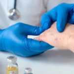 What Are Hives? Causes, Diagnosis, Types & Treatment / What Are Hives? / What Do Hives Look Like? / What Causes Hives? / How Are Hives Diagnosed? / Are Hives Dangerous? / How Are Hives Treated? / What About Home Remedies? / What If Hives Keep Coming Back? / Managing Chronic Hives / Can Hives Be Prevented? / Are There Long-Term Effects of Hives? / When to See a Doctor / Rare and Unusual Types of Hives / Common Myths About Hives / Hives vs. Other Skin Conditions / FAQs On What Are Hives / Palm Beach Dermatology Group / PGA Dermatology