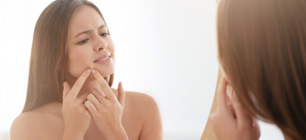 How to Get Rid of Whiteheads