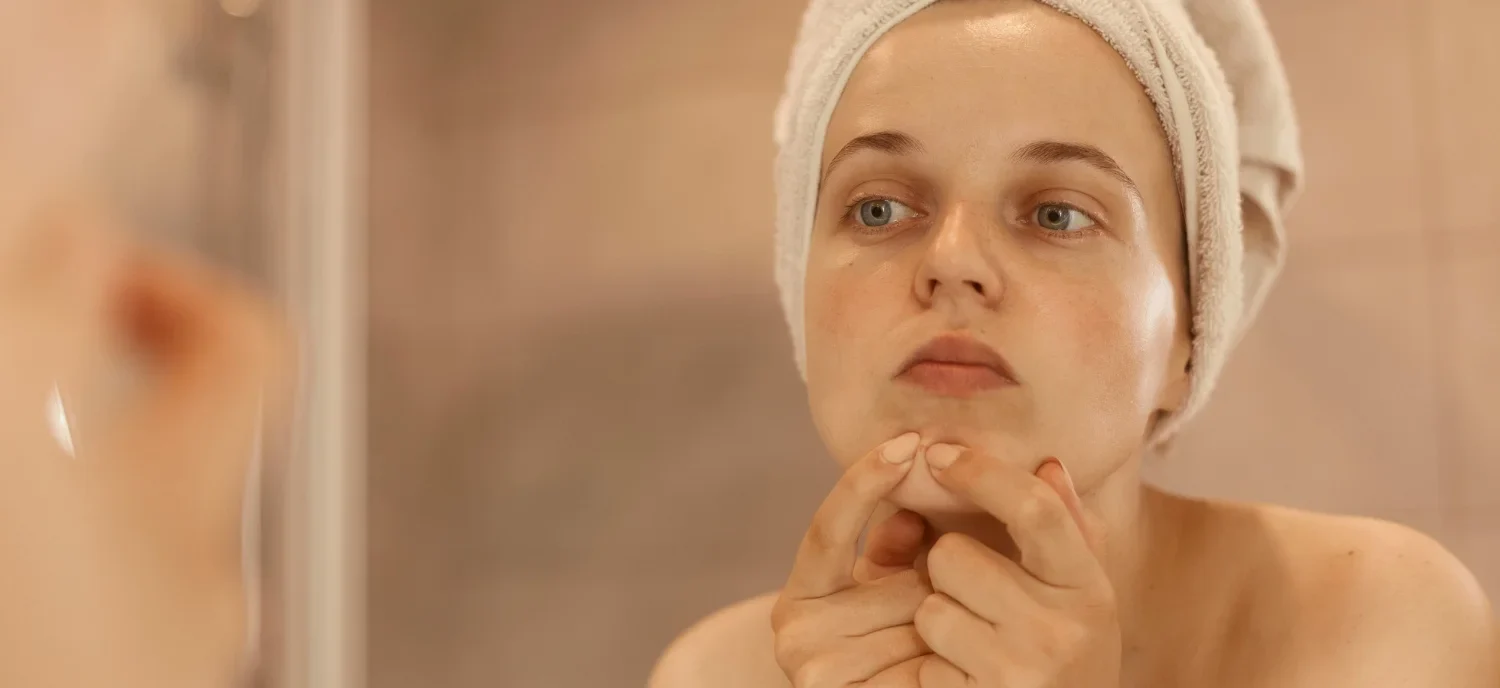 What Are Whiteheads? A Complete Guide to Causes and Treatments / Understanding What Whiteheads Are / The Science Behind Whitehead Formation / Why Do Whiteheads Happen? Common Triggers / Whiteheads vs. Other Skin Issues: What’s the Difference? / Common Areas Where Whiteheads Appear / Myths About Whiteheads: Debunking Common Misconceptions / At-Home Remedies for Treating Whiteheads / Medical Treatments for Persistent Whiteheads / Prevention Tips: How to Avoid Whiteheads / The Impact of Diet on Whiteheads / Managing the Emotional and Social Impact of Whiteheads / When to See a Dermatologist for Whiteheads / Building a Long-Term Skincare Routine to Prevent Whiteheads / Palm Beach Dermatology Group
