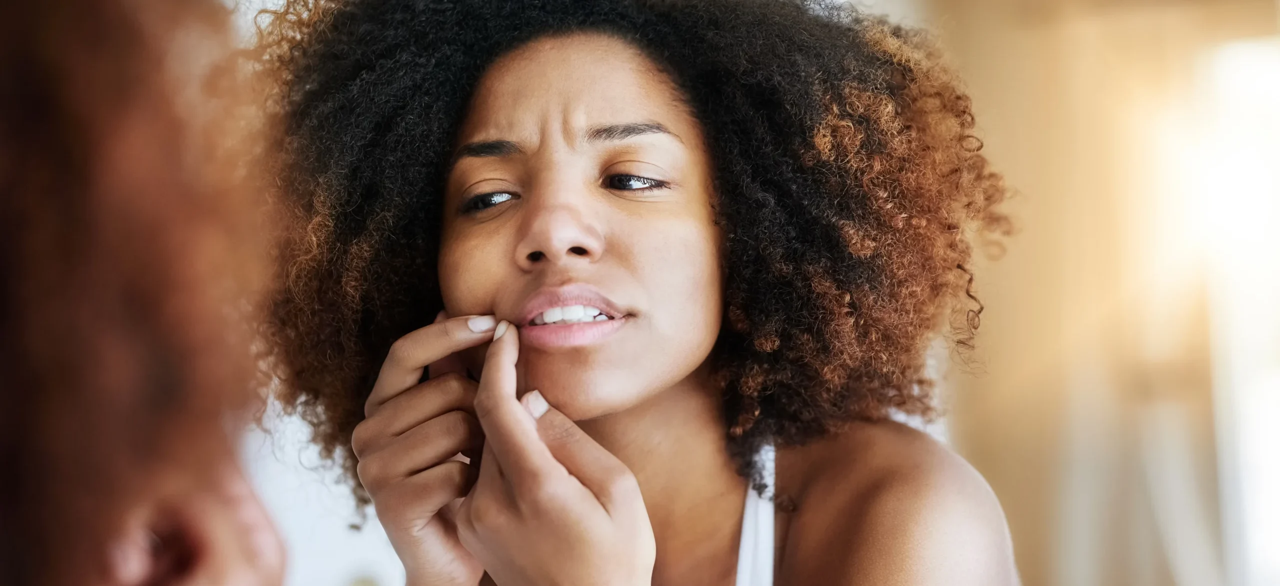 When her skin has acne - Do Whiteheads Disappear on Their Own? Causes and Treatment / What Exactly Are Whiteheads? / Do Whiteheads Disappear on Their Own? / Risks of Waiting for Whiteheads to Go Away / Safe Ways to Help Whiteheads Clear Faster / What You Should Not Do / Preventing Whiteheads in the First Place / When to See a Dermatologist / Palm Beach Dermatology Group / PGA Dermatology