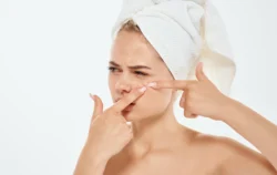 Frustrated woman gesturing with hands and a towel on her head bare shoulders - How to Prevent Blackheads: A Complete Guide - Palm Beach Dermatology Group