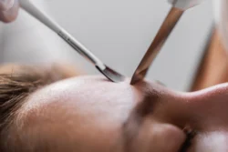 ultrasonic cleaning of the skin close up - What Are Blackheads? Causes, Removal & Prevention - Palm Beach Dermatology Group