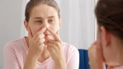 Young woman looking in mirror and squeezing pimples on her nose - How to Get Rid of Blackheads on Nose and Ears - Palm Beach Dermatology Group - PGA Dermatology 