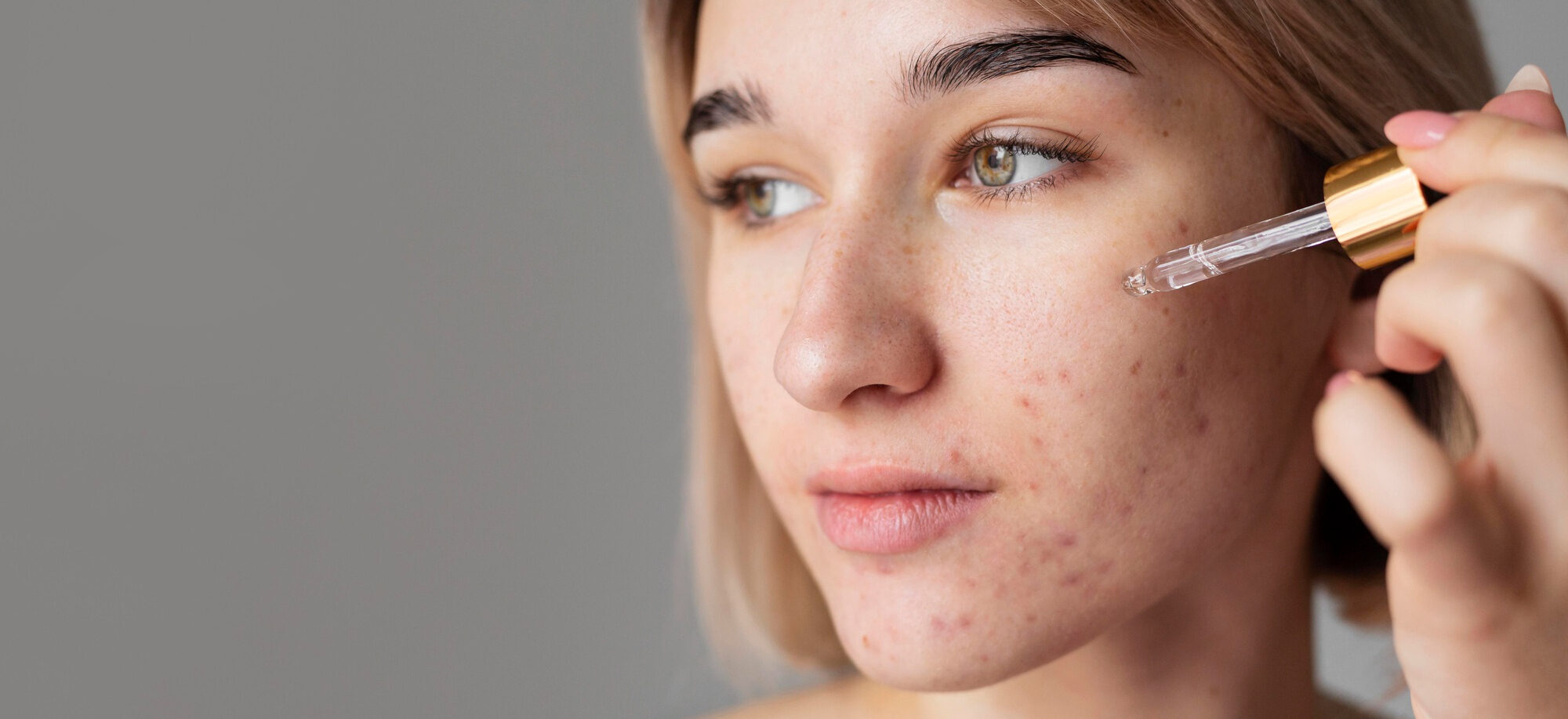 close up woman using serum - Is Hyaluronic Acid Good for Acne? A Complete Guide