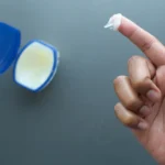 Close up of man hand using petroleum - Is Vaseline Good for Eczema? Benefits, Drawbacks & Best Ways To Use it - Palm Beach Dermatology Group