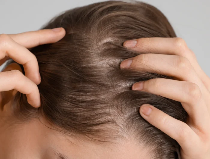 What Causes Hair Loss?