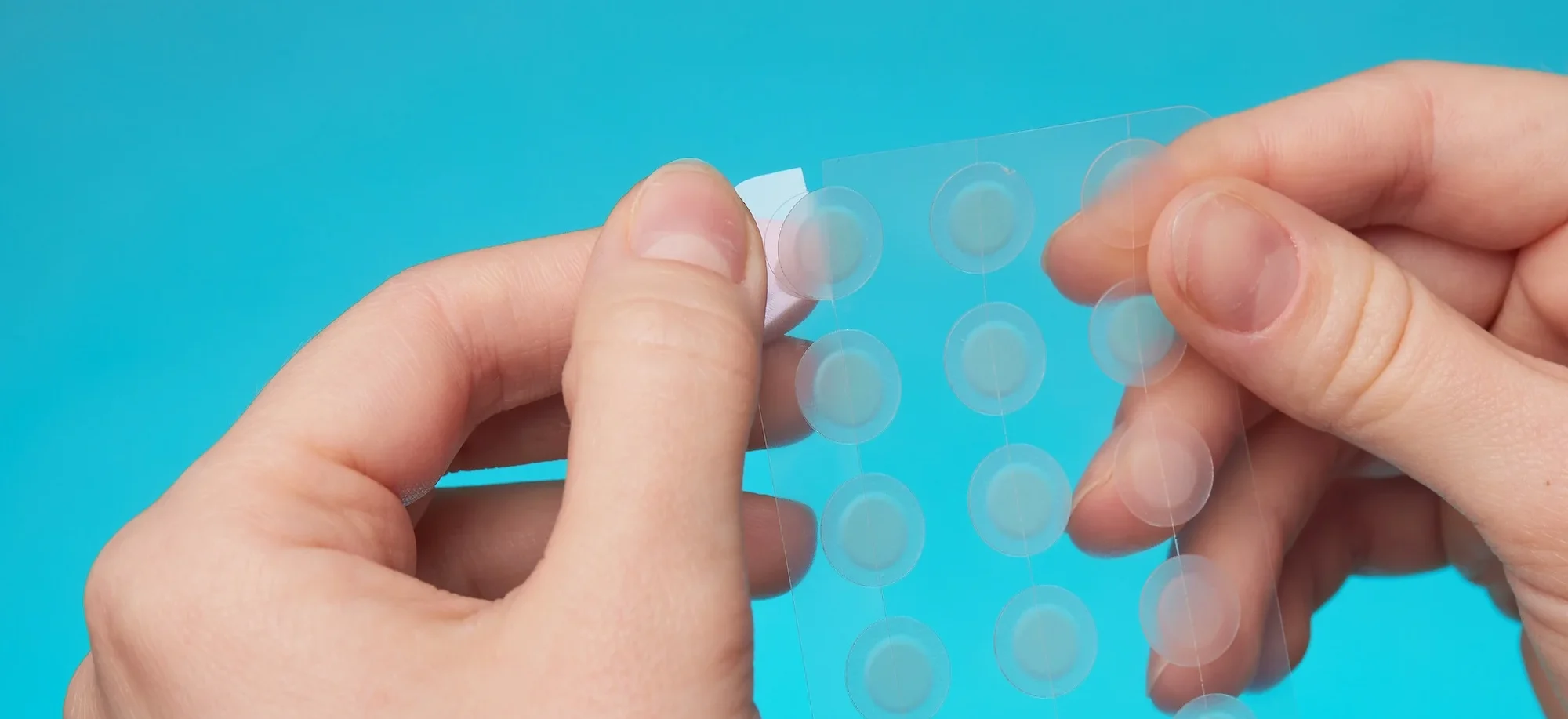close up round acne patch on finger on blue - Do Pimple Patches Work on Blackheads?