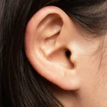 close up view of caucasian female ear - Blackheads in Ear: Causes, Symptoms, Safe Removal, Treatment, and Prevention
