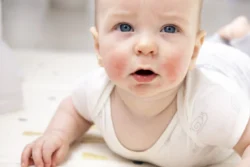 baby lying on tummy with red cheeks