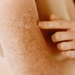 close up womans arm with dry skin -What Causes Dry Skin? Common Reasons & Solutions