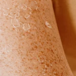 close up view of skin with sun damage - Can Dry Skin Cause Spots? Causes, Myths & Routine Guide