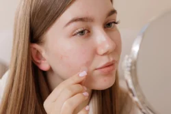 woman applying acne patch in mirror at home